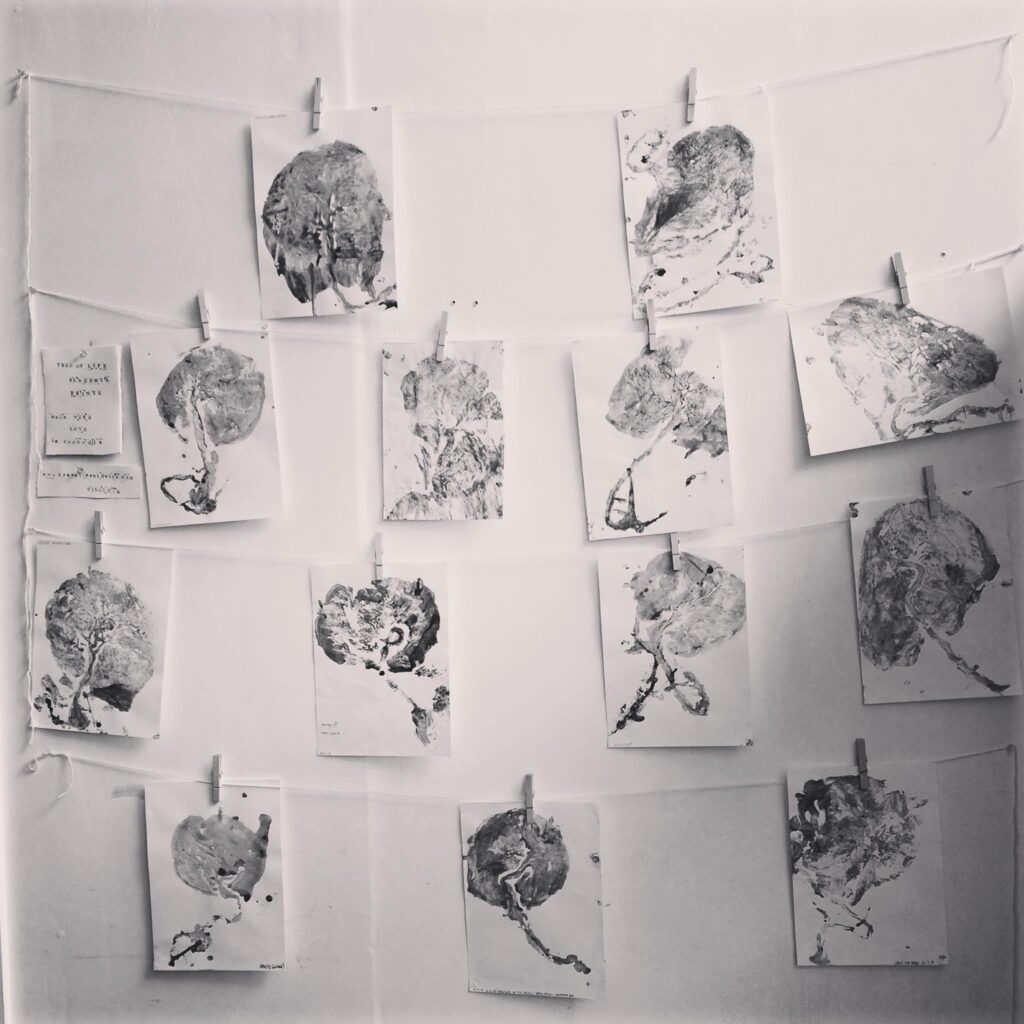 placenta encapsulation brighton and eastbourne