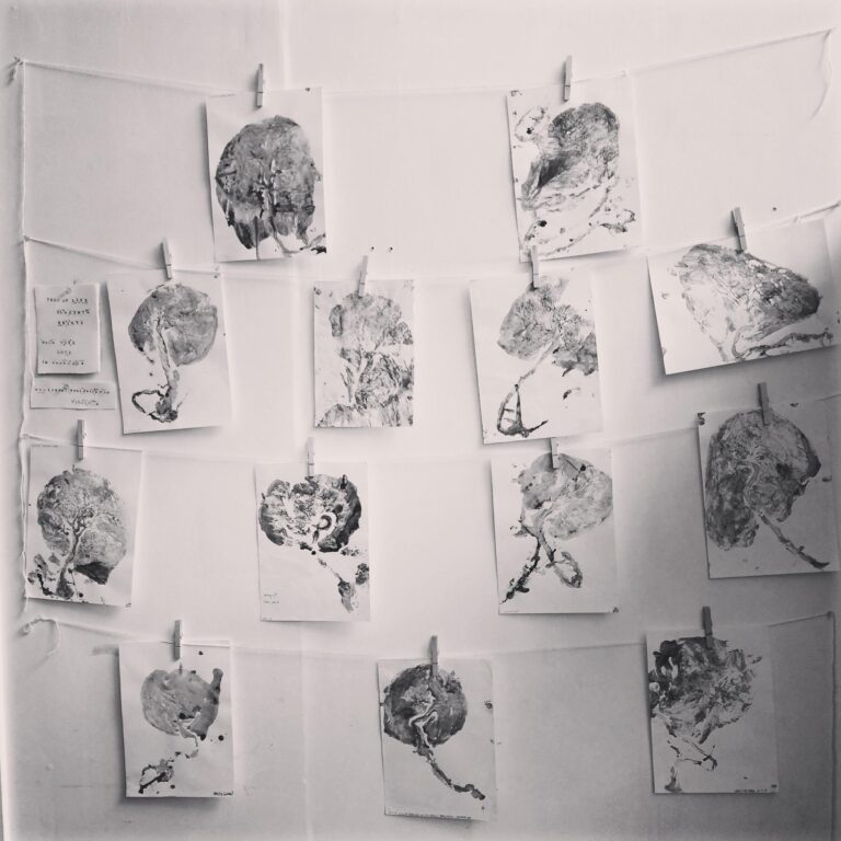 placenta encapsulation brighton and eastbourne