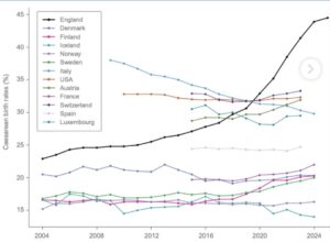 cesarian section rate in the uk 2026