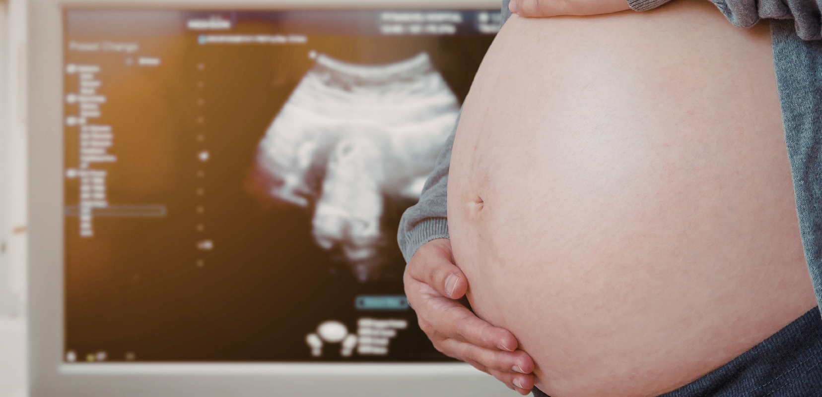 LATE PREGANCY SCAN